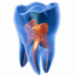 Endodonti (Kanal tedavisi)